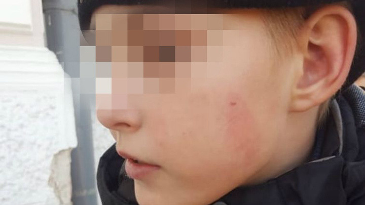 «Мой сын получил удар в челюсть»: в Ярославле рабочий избил детей в музее