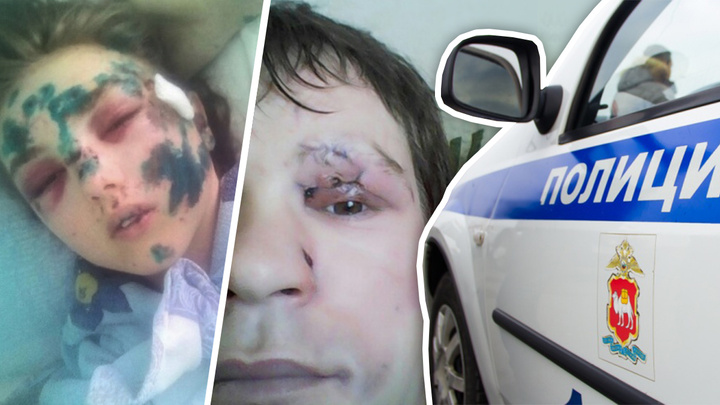 «За год дела нет»: пострадавшие в аварии с южноуральским полицейским обвинили МВД в волоките