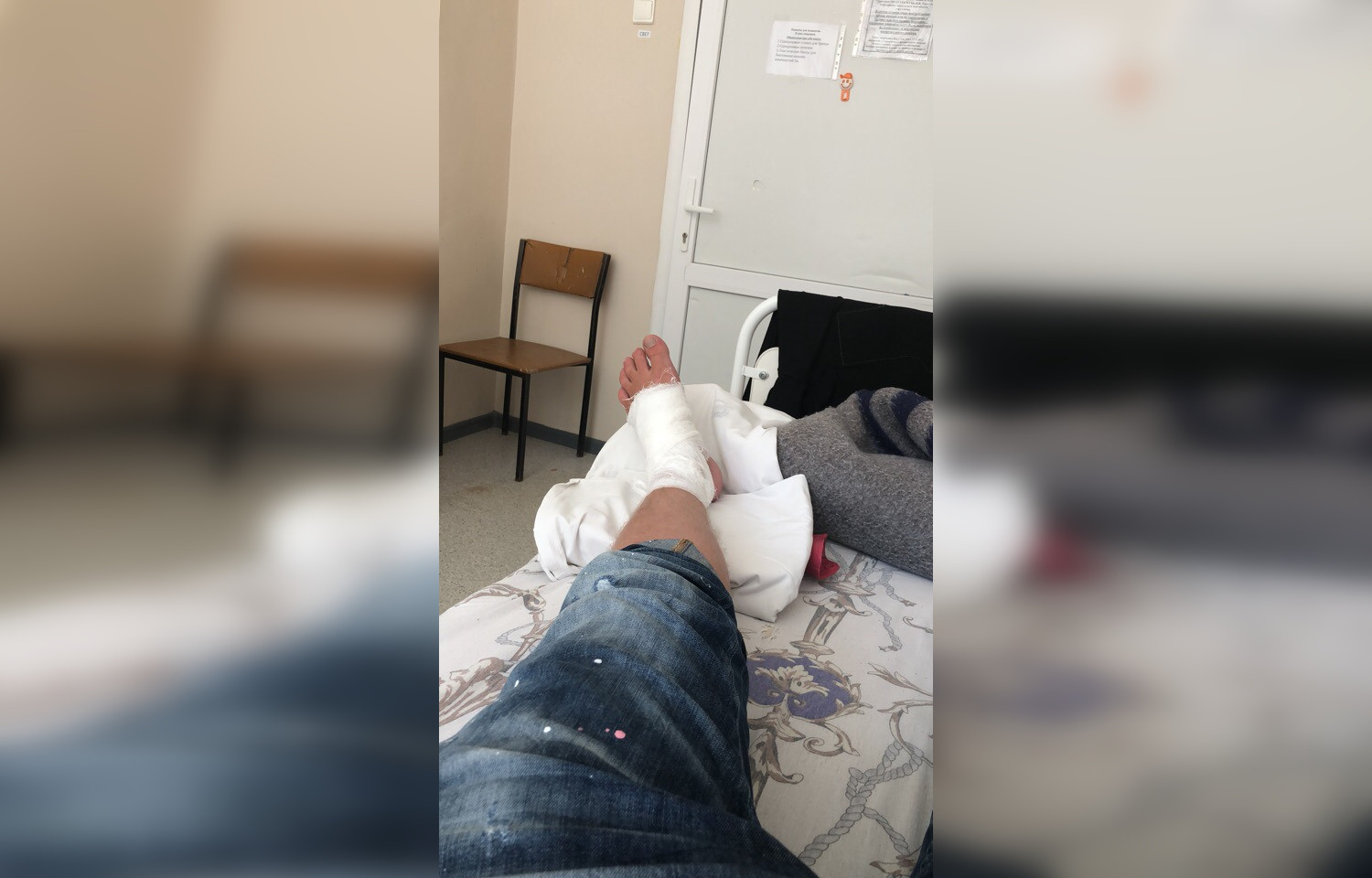 Активист сообщил, что получил травму ноги Активист сообщил, что получил травму ноги
