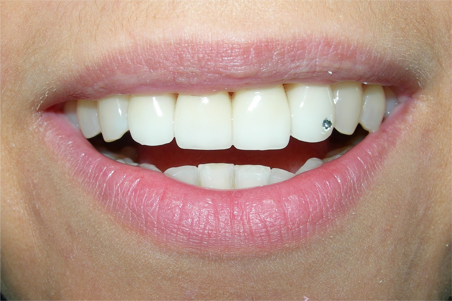 Работа стоматолога-ортопеда клиники RecomenDent