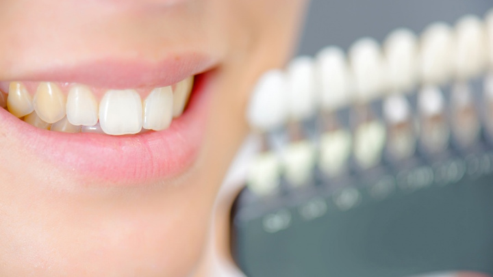 Почему зубы меняют цвет, и как с этим бороться