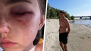 Отдыхающий на пляже ударил девушку после неудачной попытки познакомиться