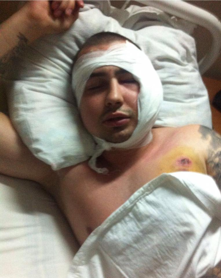 24-летний Сергей Сычев пережил 6-часовую операцию по извлечению резиновой пули из головы