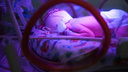 «У врачей золотые руки»: уфимские кардиохирурги прооперировали недоношенную девочку