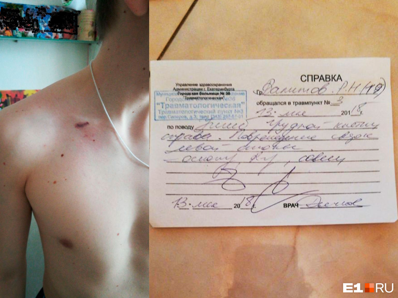 Врачи констатировали у Романа ушиб грудной клетки и повреждение связок левой стопы Врачи констатировали у Романа ушиб грудной клетки и повреждение связок левой стопы