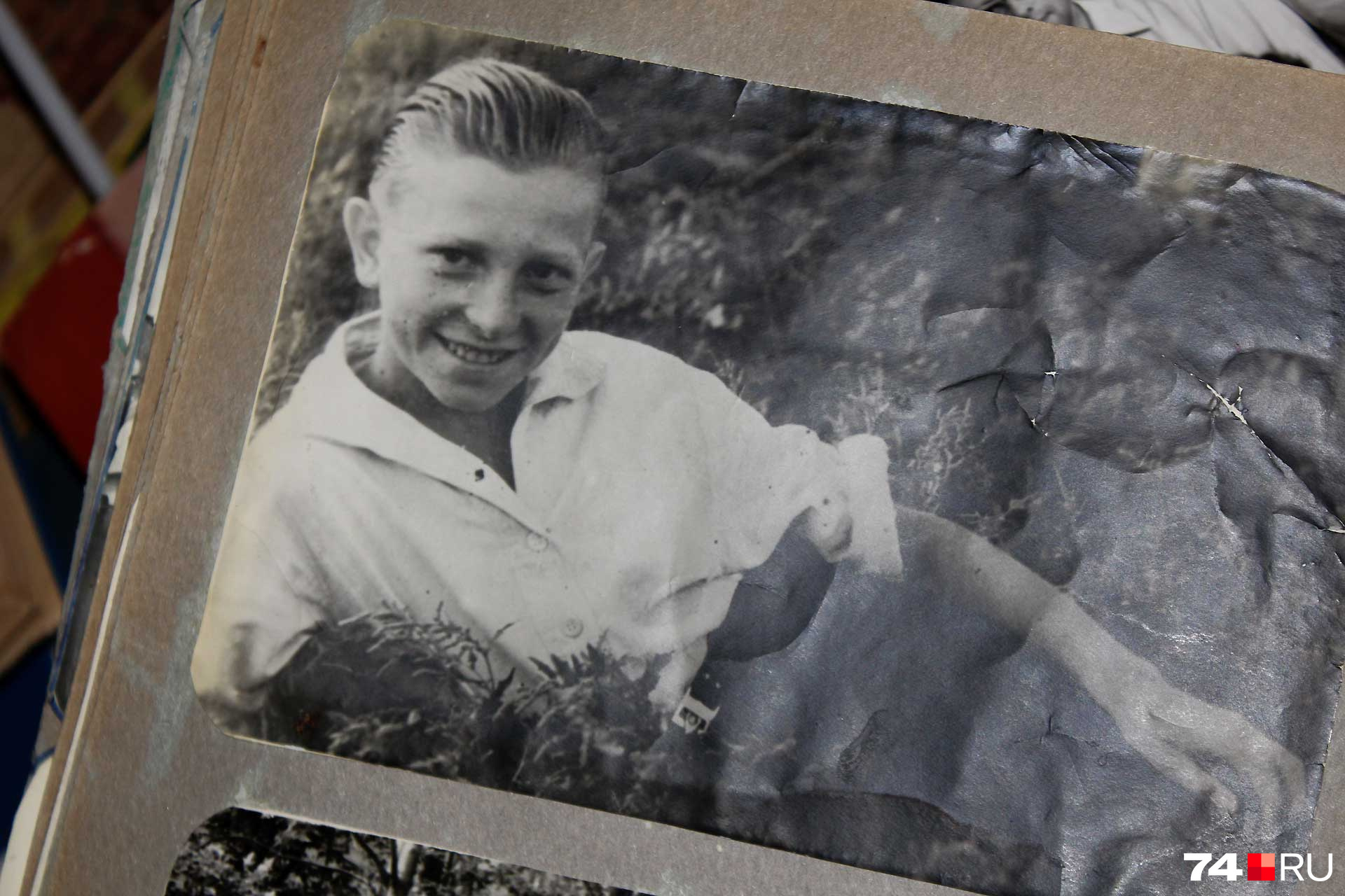 Игорь Вишев в 14 лет получил химический ожог и перенес больше 30 операций, зрение было потеряно навсегда Игорь Вишев в 14 лет получил химический ожог и перенес больше 30 операций, зрение было потеряно навсегда