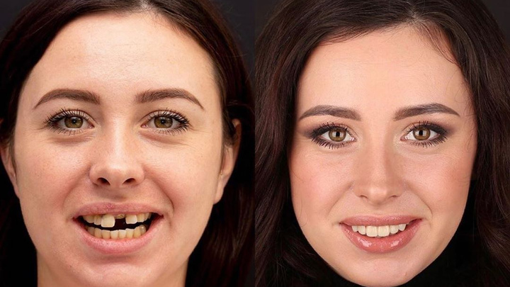 Им всё по зубам: смотрим, как преобразились улыбки тюменцев после похода к стоматологу
