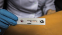 Новосибирец специально заразил девушку ВИЧ. Ему дали почти 2 года строгого режима