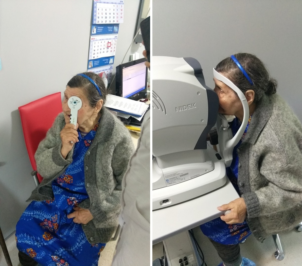 Бабушке
поставили диагноз: зрелая катаракта
правого глаза и незрелая
катаракта левого