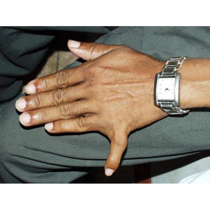 Дать пять. Дай пять логотип. Дай пять логотип. Тодд из клиники. Тодд дай пять.