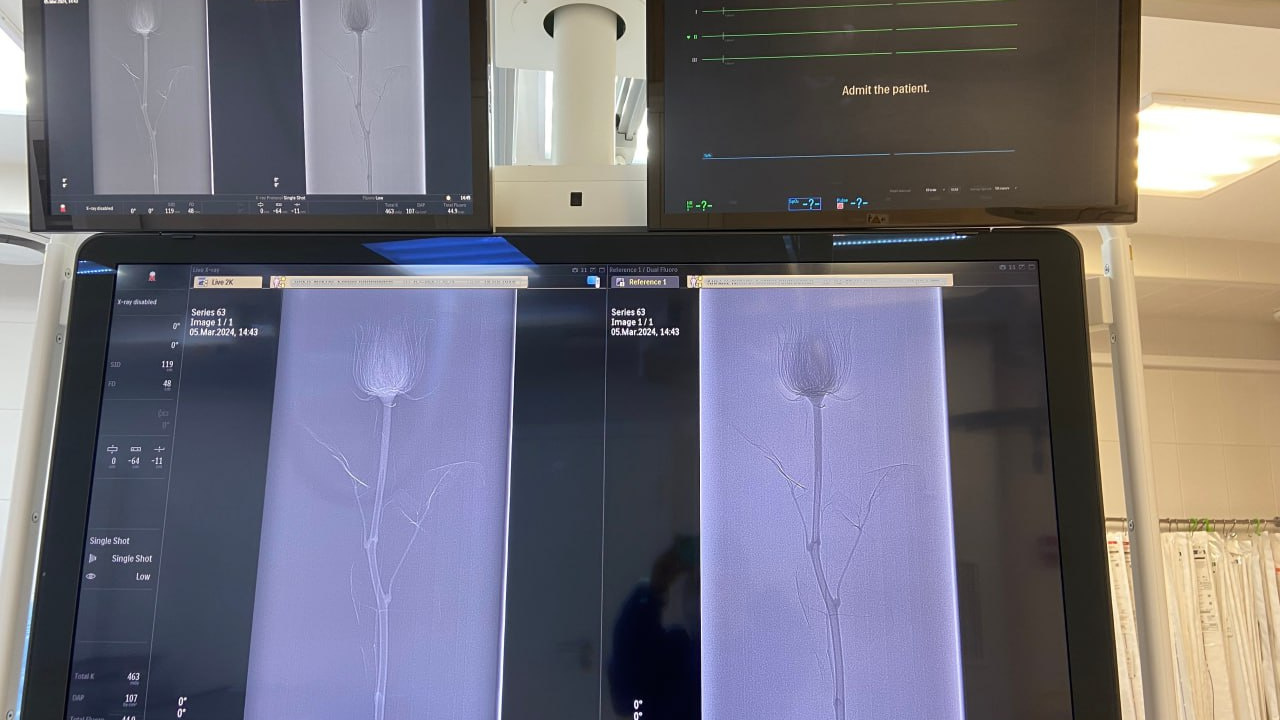 Анатомия нежности: сургутский врач показал, как выглядит роза под рентгеном
