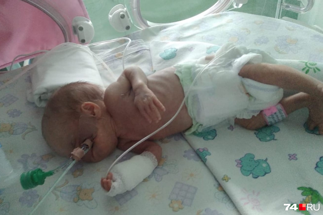 Девочки нуждались в кислородной поддержке, так как родились на два месяца раньше срока Девочки нуждались в кислородной поддержке, так как родились на два месяца раньше срока