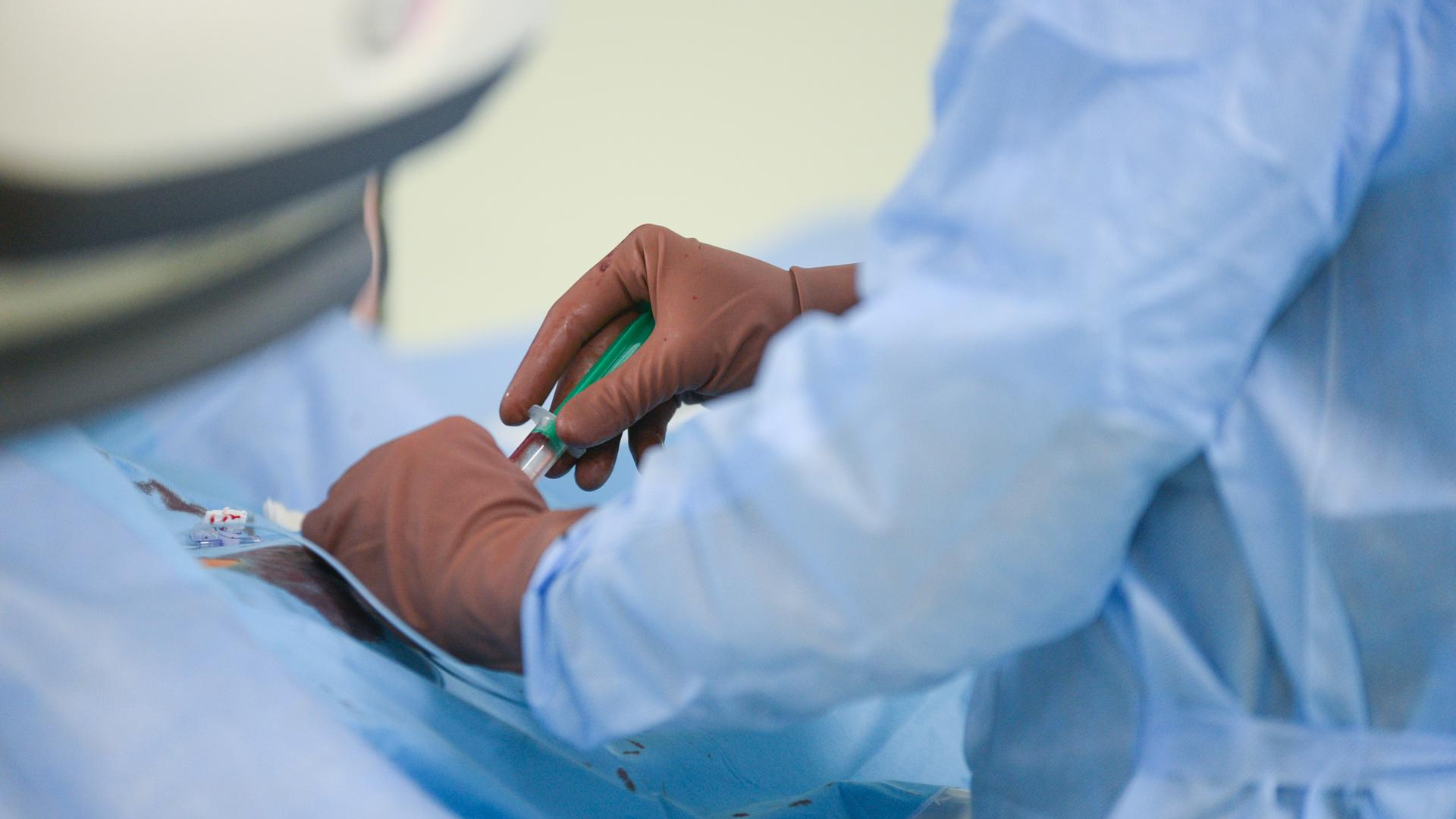 В организм попала страшная инфекция: врачи спасли руку кемеровчанина от ампутации