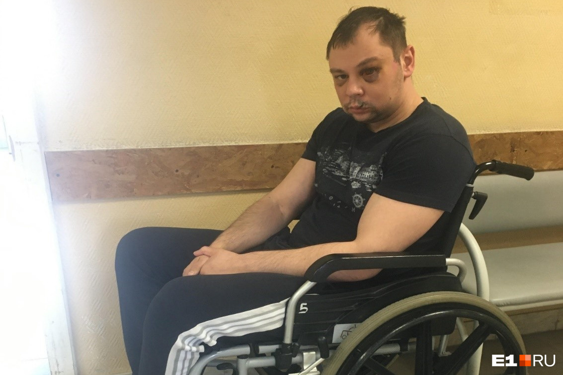 «По голове просто прыгали». В Екатеринбурге представители диаспоры жестоко избили парня и прострелили ему ногу