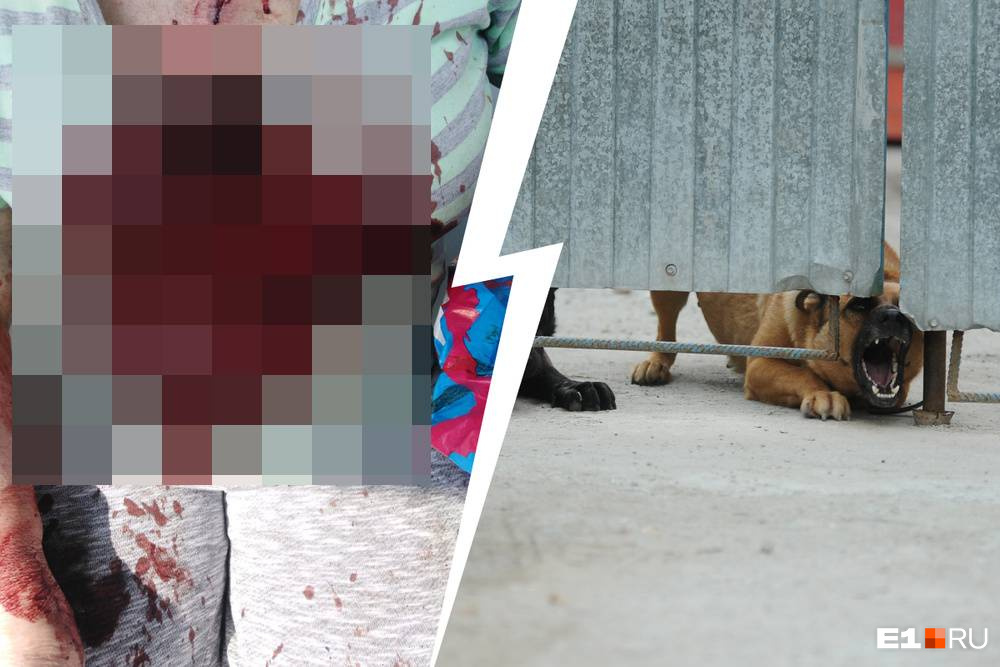 В садах под Екатеринбургом стая бродячих собак разодрала женщину. Пострадавшая потеряла много крови