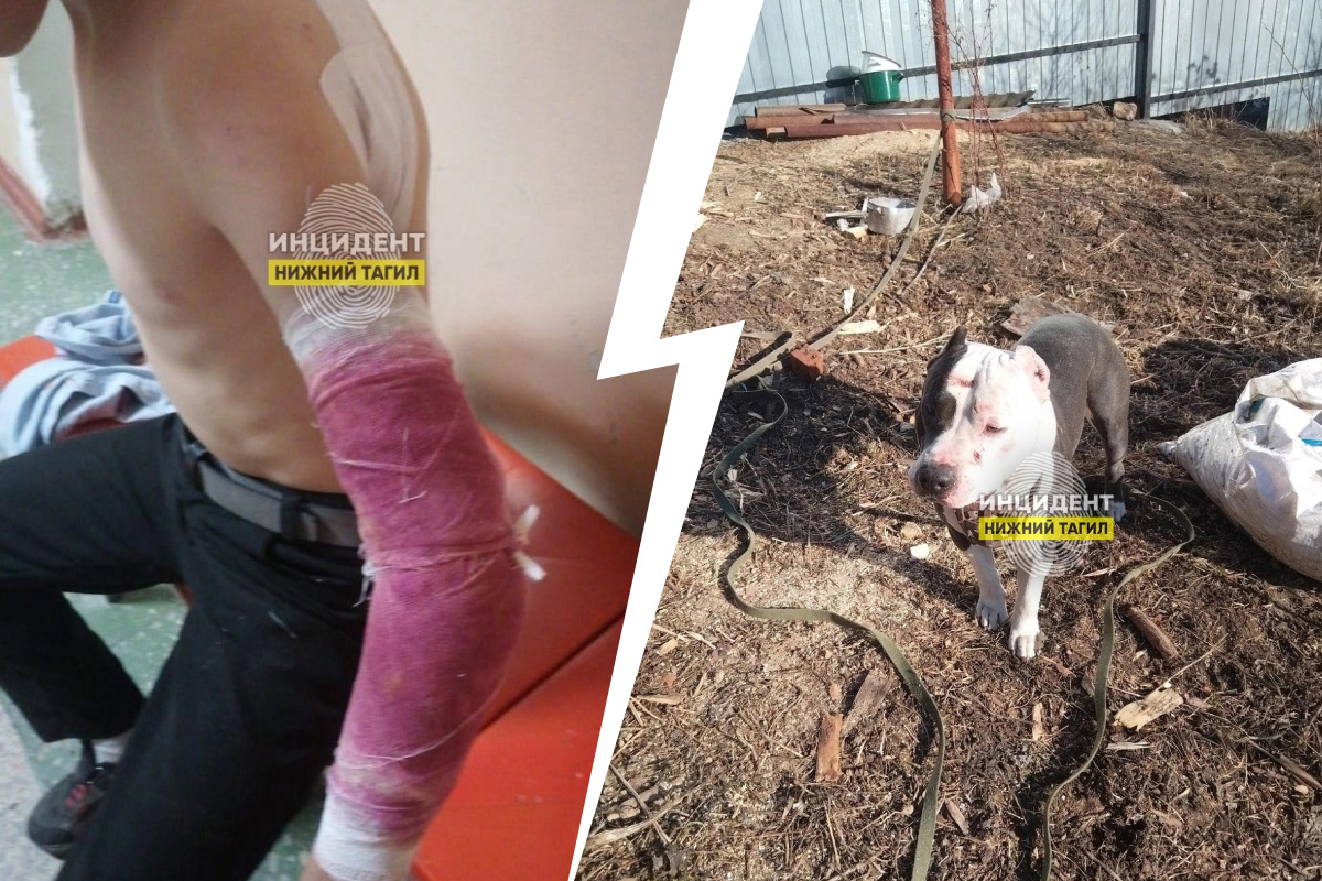 «Рвала на части»: на Урале бойцовская собака набросилась на 10-летнего мальчика в присутствии хозяйки