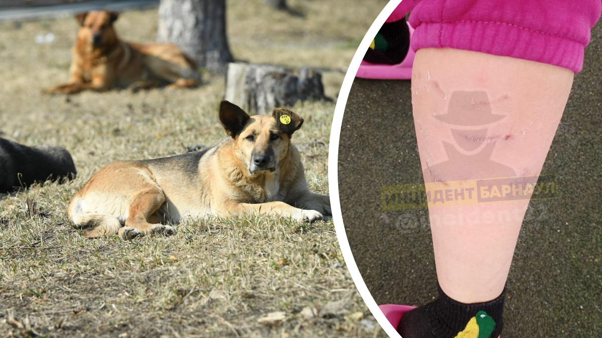 «Укусила за голень»: стая собак напала на девочку во дворе школы в Сибири