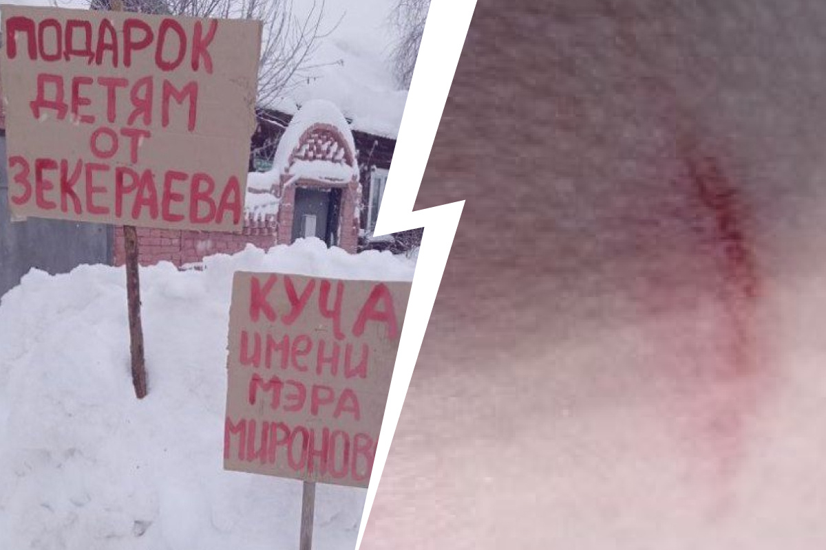 «Оттаскали за волосы, испинали». На Урале двое мужчин избили женщину, которая пожаловалась на кучу снега