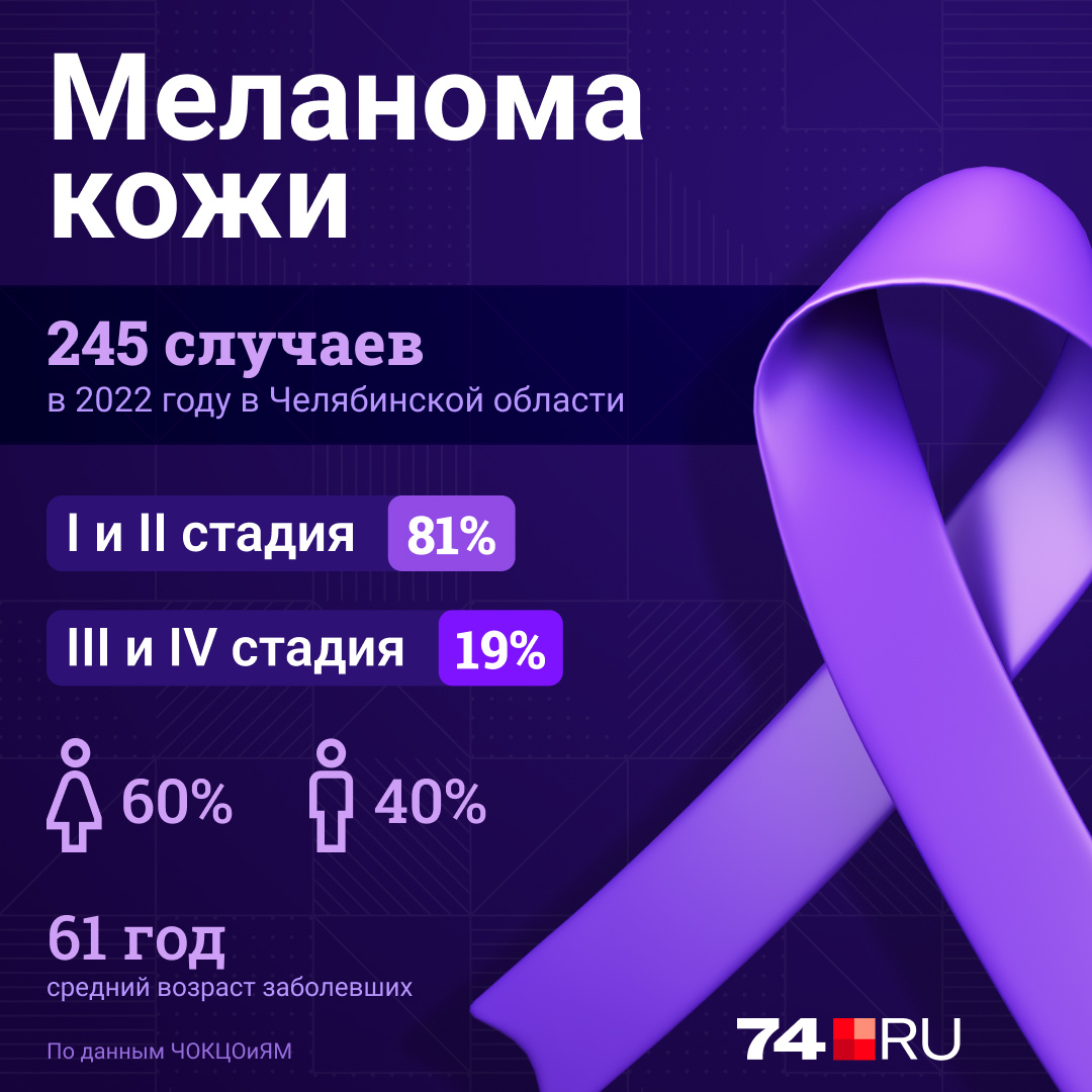 Как отличить родинку от меланомы и можно ли удалять родинки на коже - 30  мая 2023 - 74.ru