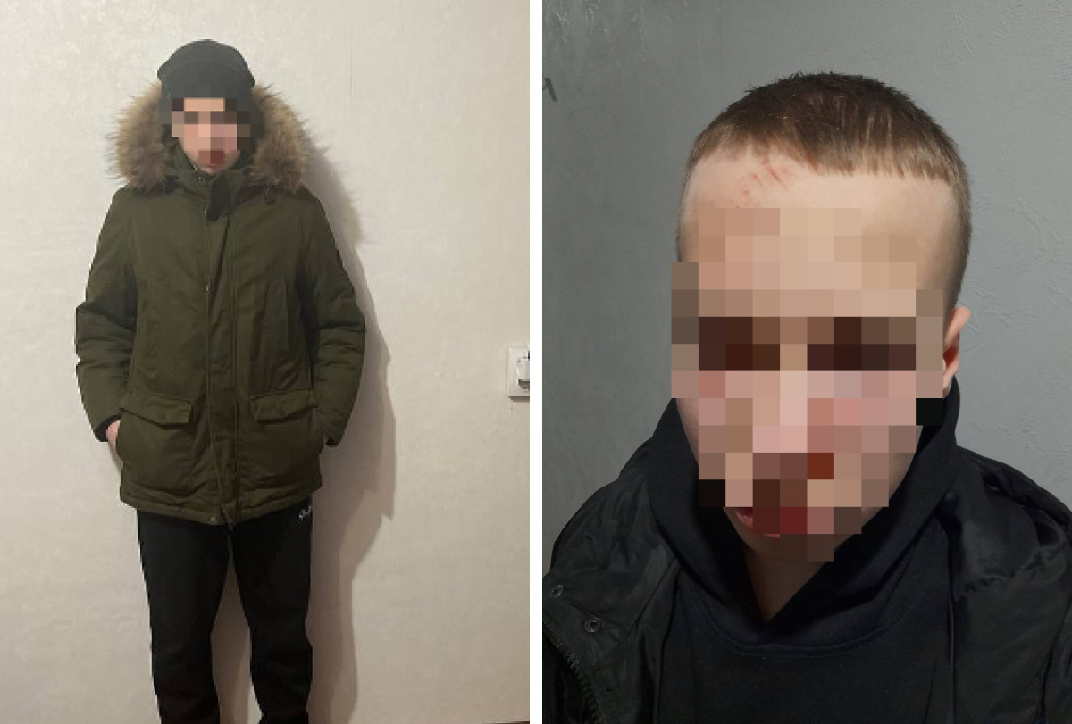 «Избивали сначала три, потом пять». В Екатеринбурге подростки толпой расправились с 13-летним школьником