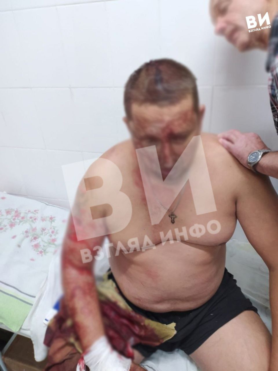 Одного из пострадавших осматривают врачи Одного из пострадавших осматривают врачи