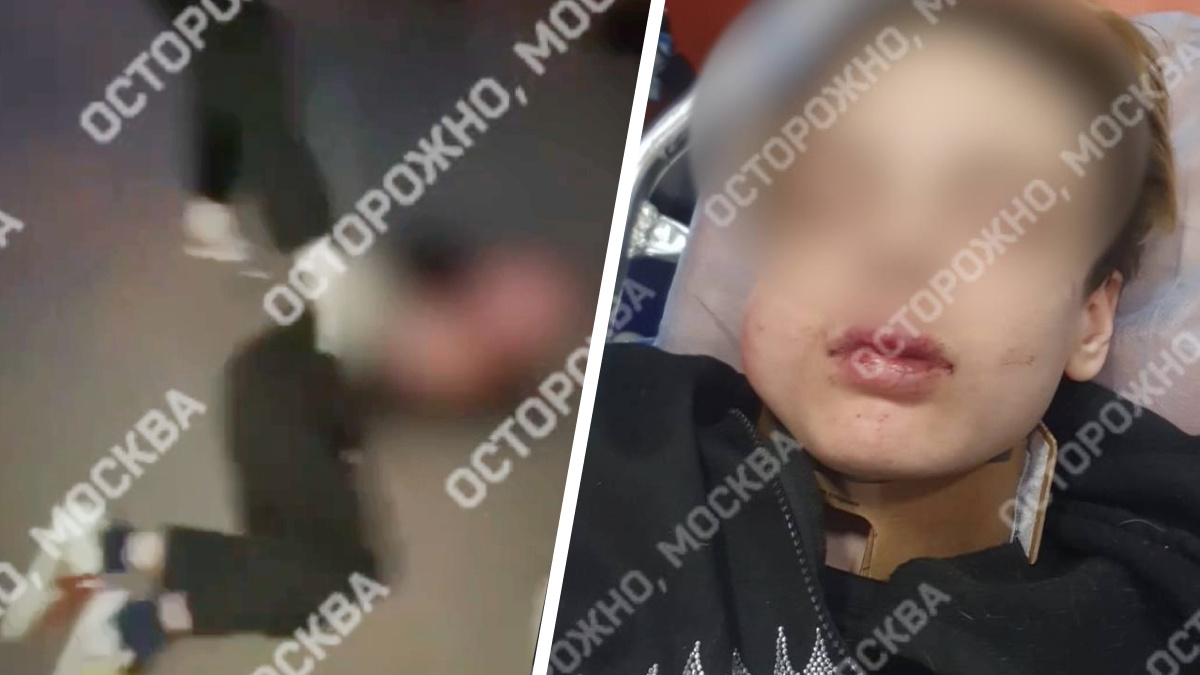«20 человек били до потери сознания». На севере Москвы подростку раздробили челюсть за интимную фотографию <nobr class="_">14-летней</nobr> девушки