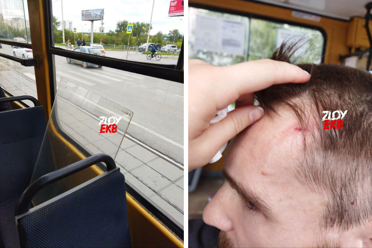 «Прямо в голову»: в Екатеринбурге турист сел в трамвай и получил в лоб отлетевшим стеклом