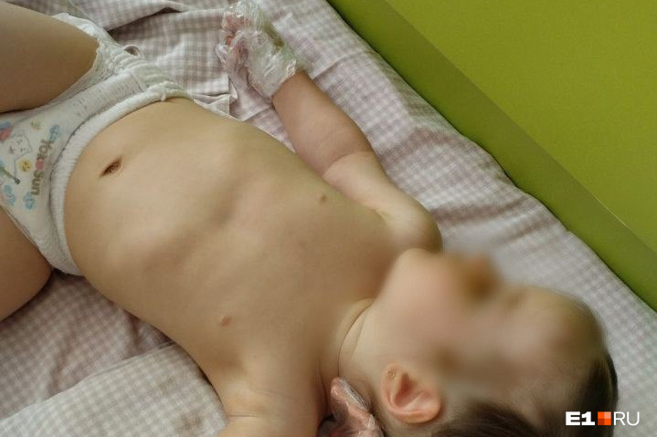 В частном детском саду в Екатеринбурге малышке перемотали руки пакетом и связали скотчем