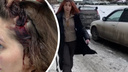 «Пошла ко мне с собакой и палкой»: в Новосибирске хозяйка алабая напала на прохожую после замечания о наморднике — видео