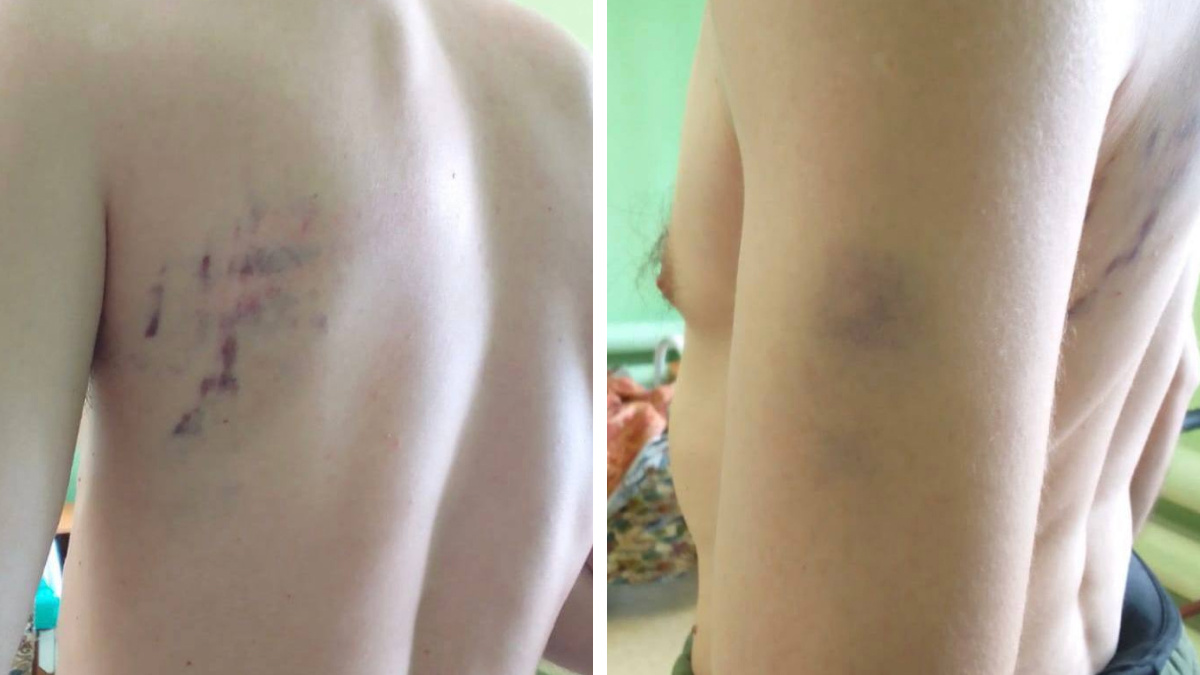 «Саша боится». Сестру избитого в татарстанском психинтернате пациента заставили извиниться на камеру