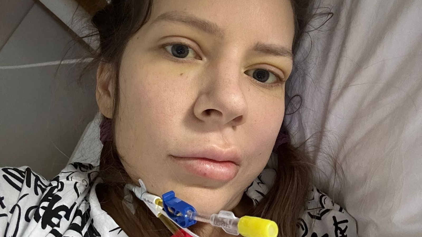 Ростовский онкоинститут объяснил, почему тяжелобольной женщине из Горловки отказали в госпитализации