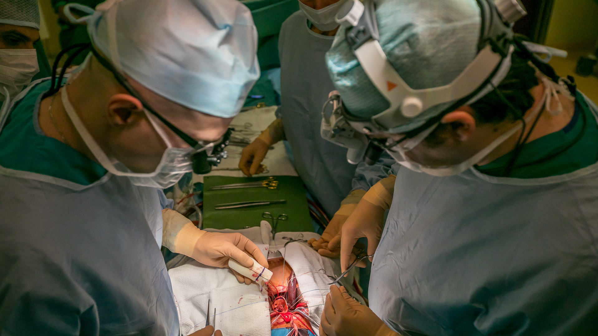 Из живота сибирячки извлекли 4-сантиметровую иглу: ее во время прошлой операции забыл хирург
