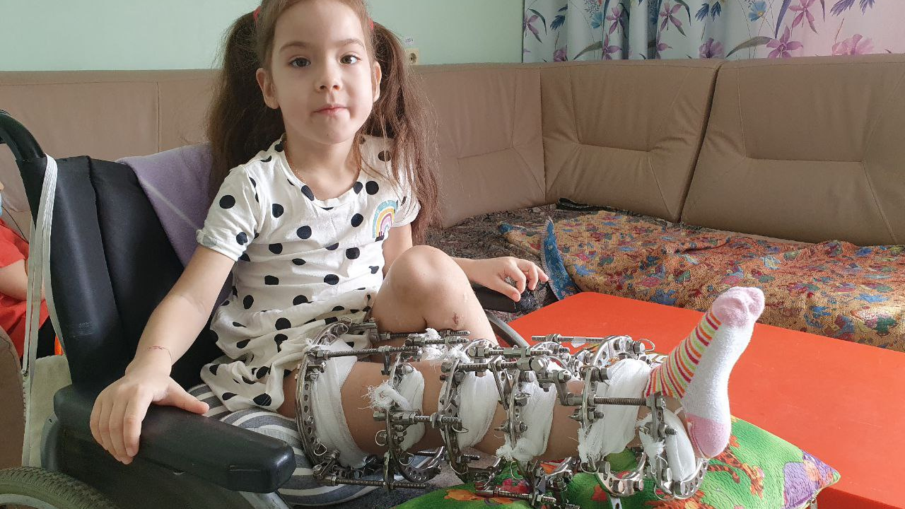 «У людей слабое представление об этой болезни»: девочка из Хакасии приехала на лечение фосфат-диабета в Курган