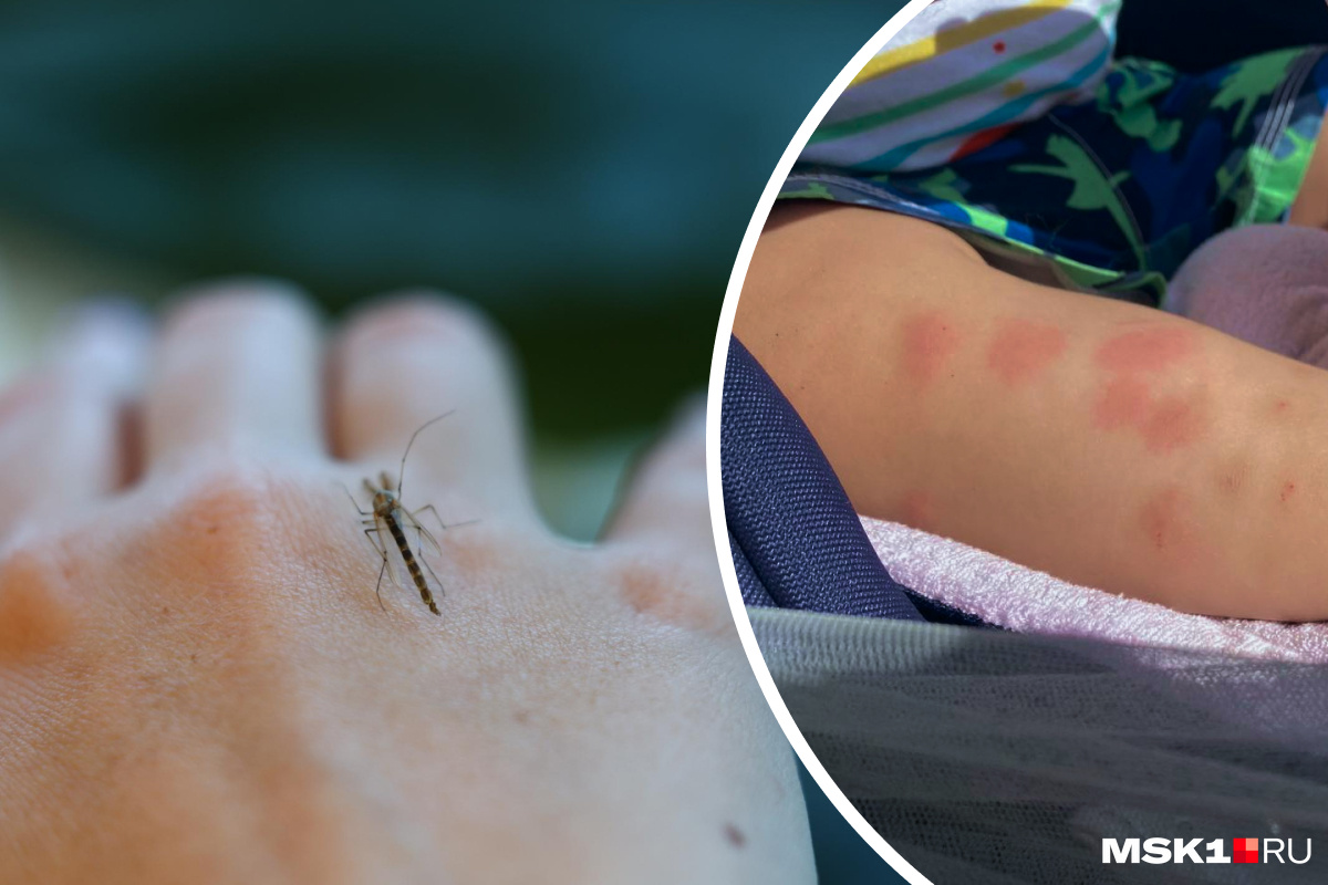 Почему комары одних кусают, а других — нет? Как защититься от кровососов: рекомендации от экспертов — в карточках