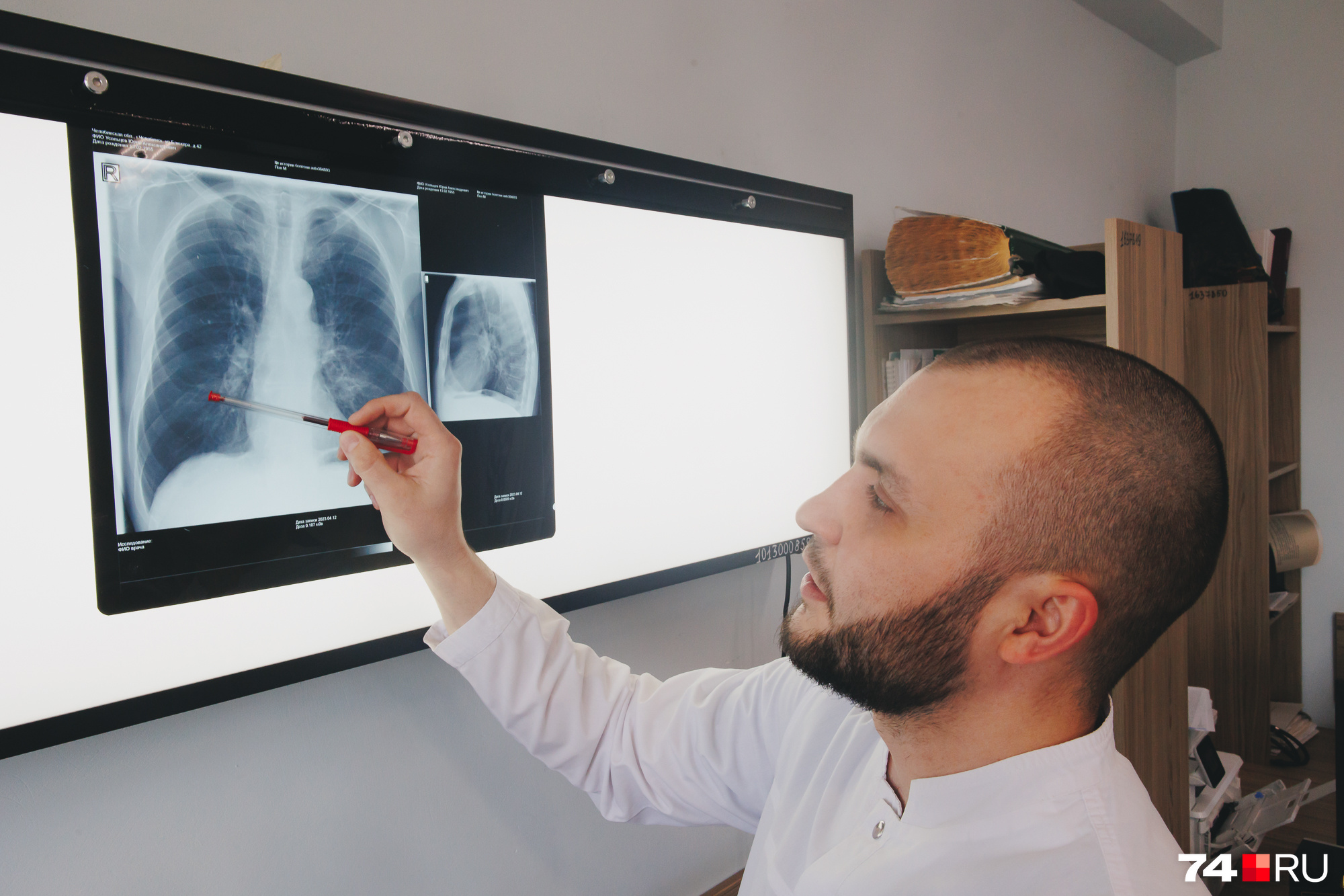 Выявить рак легкого можно с помощью флюорографии, рентгена или КТ