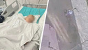 Обломок кости упирается в мозг. В Москве школьник проломил череп пятилетней девочке самокатом: подробности