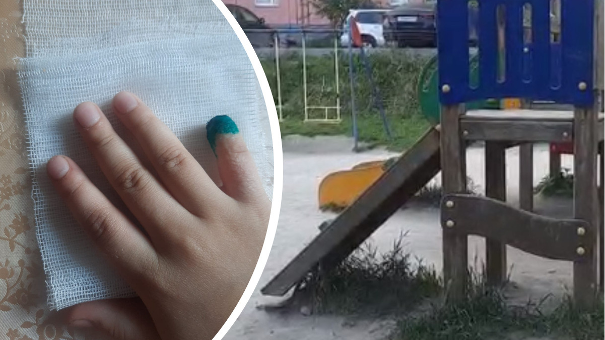 В Челябинской области девочка лишилась фаланги пальца, катаясь на горке во дворе