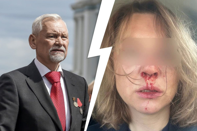 Гематомы, перелом носа. Бывшая жена обвинила депутата Госдумы в избиении