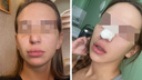 «Я просто просила его пересесть»: ревнивая блогерша сломала нос сибирячке в BlaBlaBar из-за разговора с ее мужем