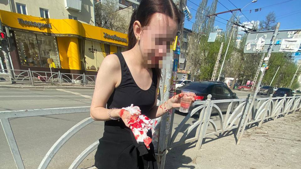В Екатеринбурге самокатчица въехала в прохожего и сломала себе нос: фото