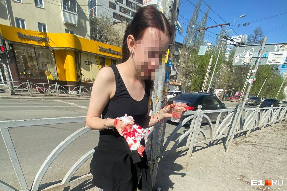 В Екатеринбурге самокатчица въехала в прохожего и сломала себе нос: фото