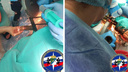 Ювелирная точность и болгарка: спасатели помогли хирургам извлечь вилы из головы новосибирца