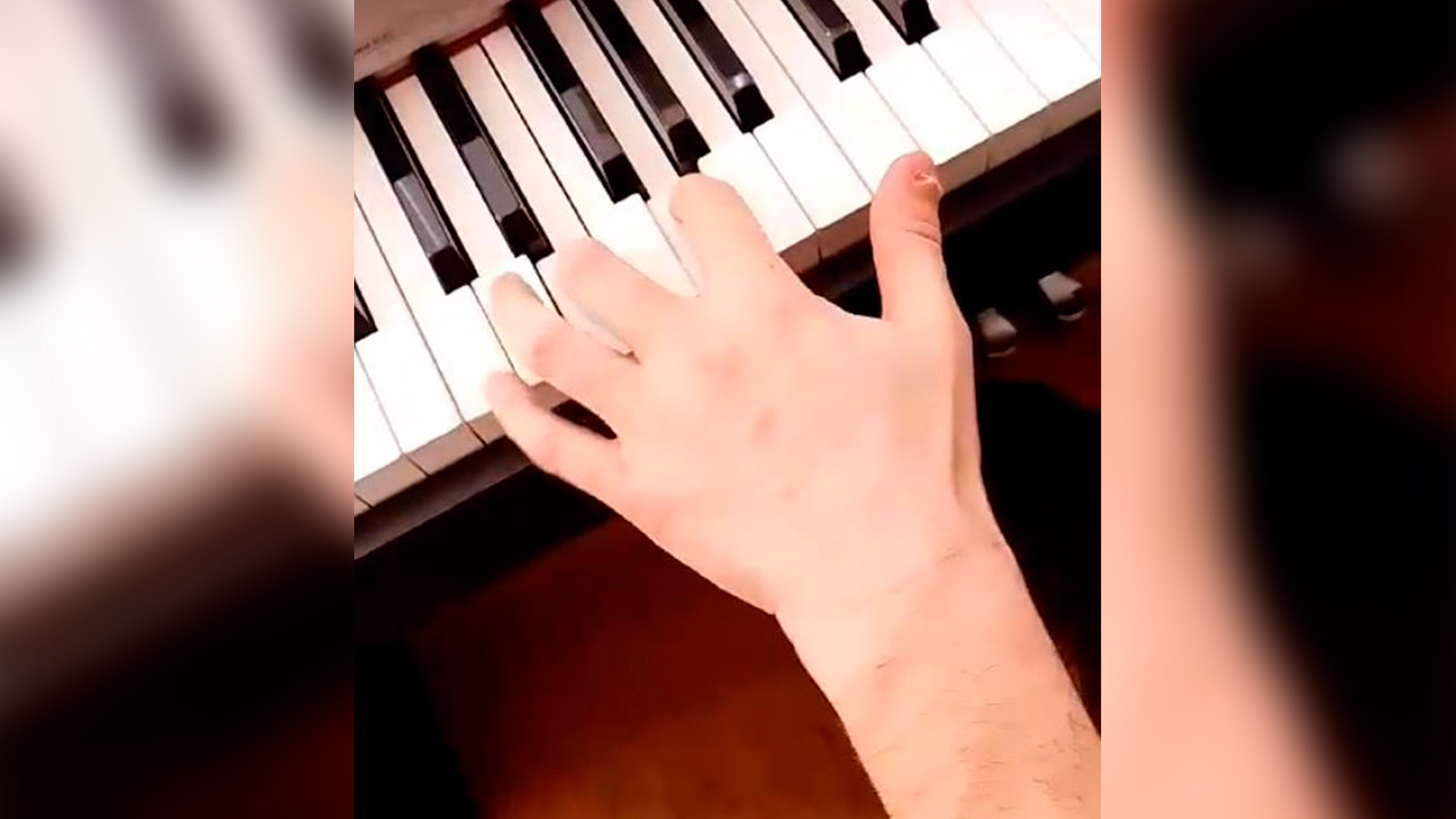Воронежский пианист, чей палец спасли от ампутации, записал видео