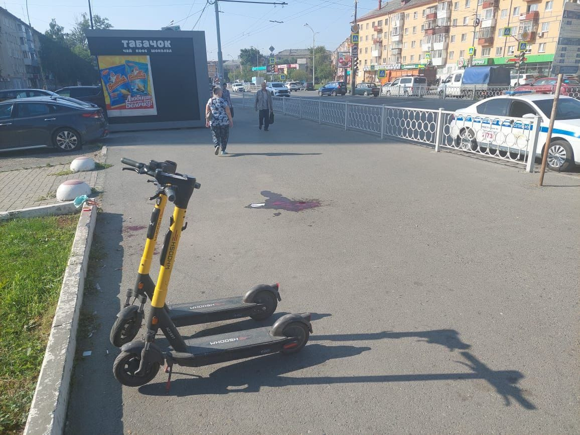 В Екатеринбурге лоб в лоб столкнулись самокатчики, оба попали в больницу