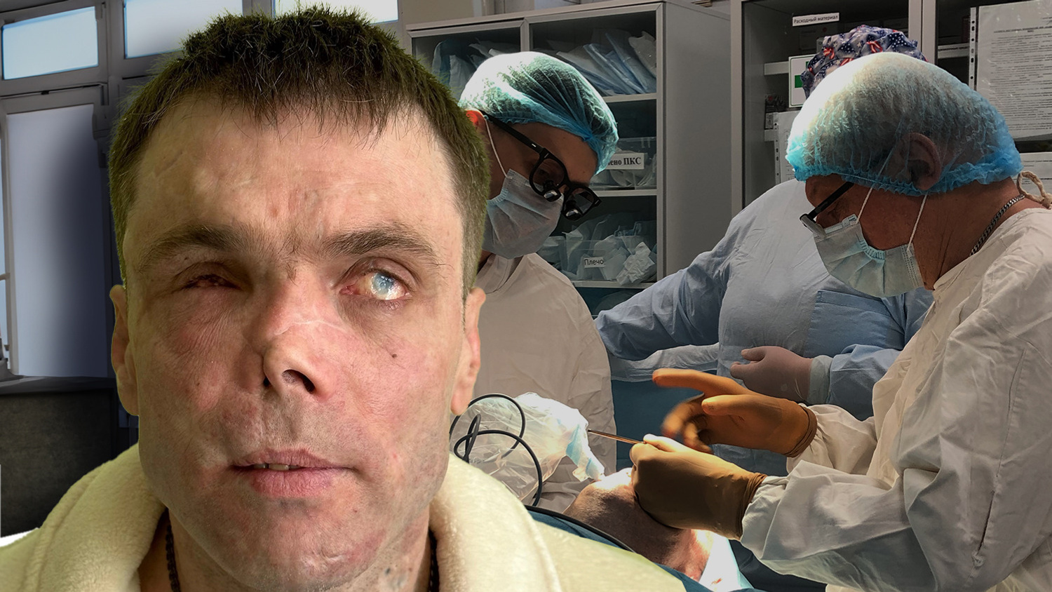 «Носик уже как нормальный стал». Хирурги из Екатеринбурга восстановили лицо ополченца, подорвавшегося на мине