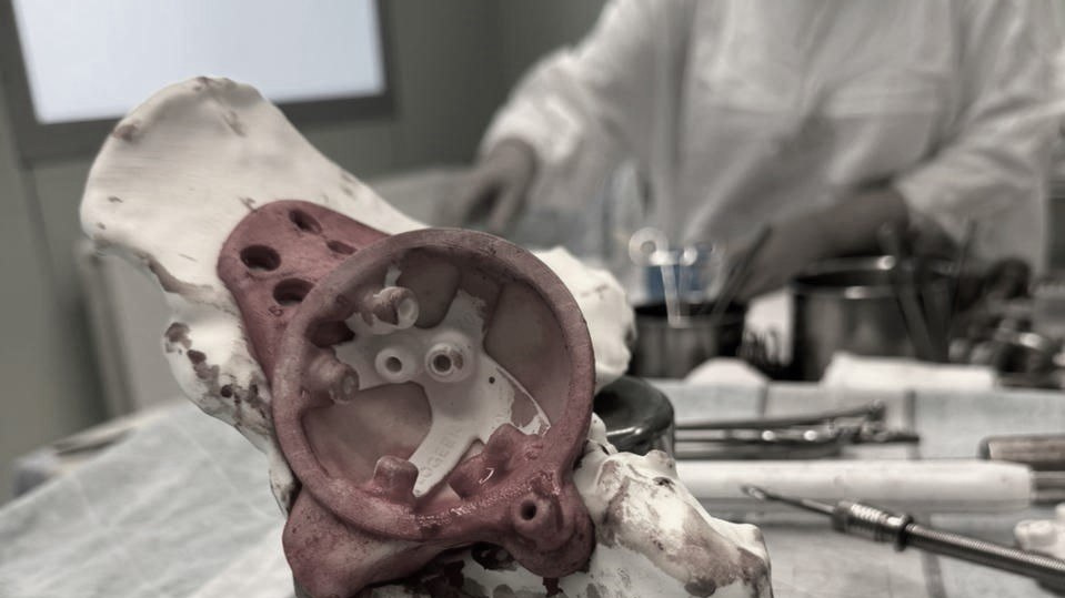 В Сургуте пациенту травмбольницы впервые установили титановый <nobr class="_">3D-эндопротез</nobr>