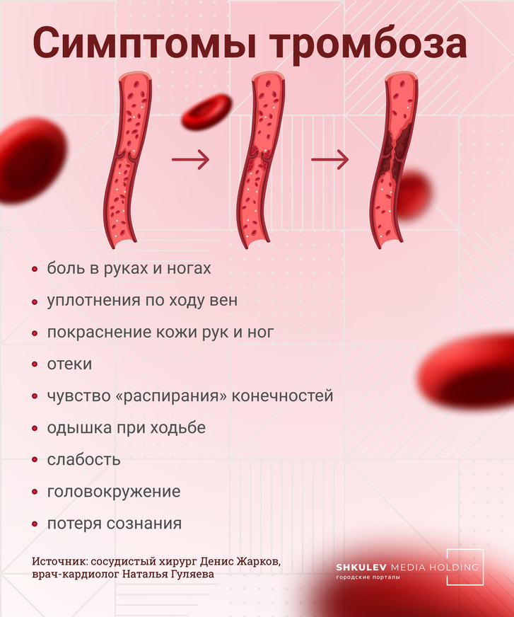Симптомы тромбоза могут быть неспецифичными, свойственными многим заболеваниям