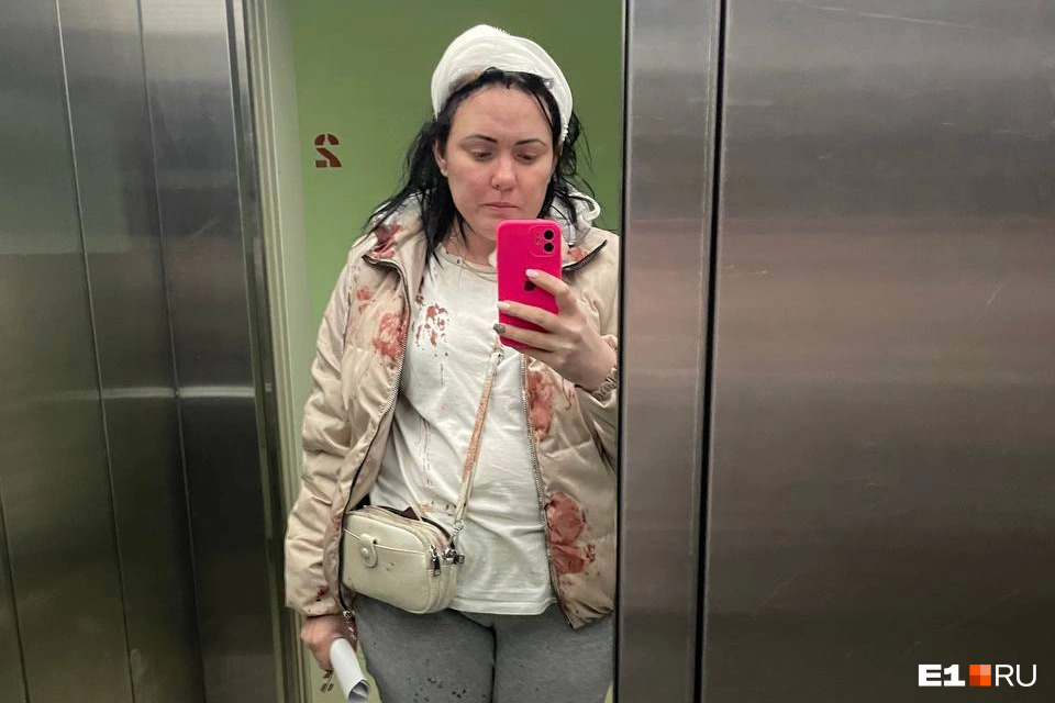 В Екатеринбурге кусок упавшей с высотки штукатурки рассек женщине голову — произошедшее попало на видео