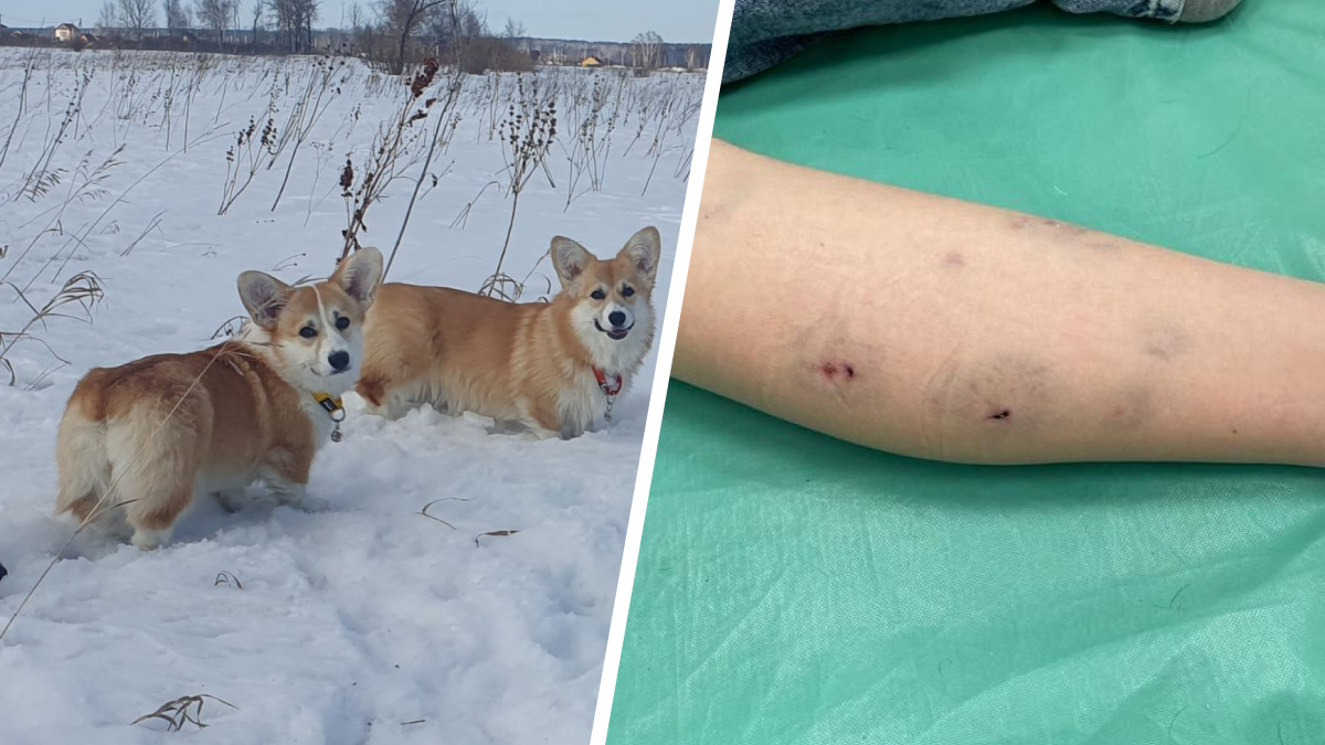 Страшнее корги зверя нет. Собака искусала девочку под Новосибирском — ее отец требует с хозяйки огромную компенсацию