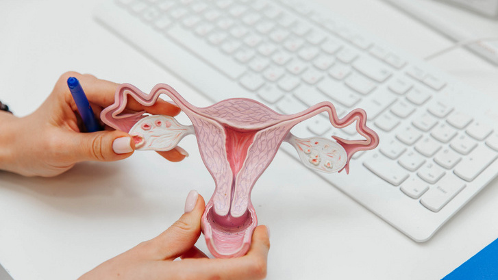 «Органы могут выходить наружу»: гинеколог — о женской проблеме, которую считают постыдной